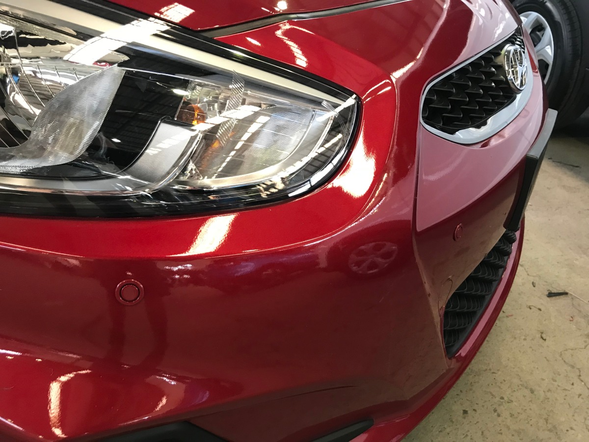 Accent Sedan 2018 Front Parking Sensors Creative Installations